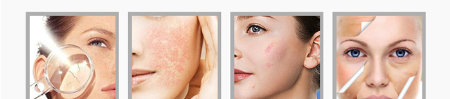 Ғ�����ۼ����o(h��)��Ĥ