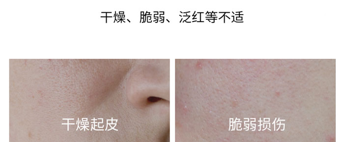 �ۃ��¶����a(b��)ˮ���o(h��)���z_04